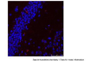 Sample Type: Mouse Brain Slices Red: primaryBlue: DAPIPrimary Dilution: 1:400 Secondary Antibody: Anti-Rabbit IgG Alexa 594Secondary Dilution: 1:400 Image Submitted By: Adahir Labrador-Garrido and Cintia Roodveldt University of Seville (HSPA9 抗体  (C-Term))