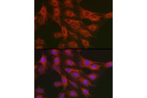 Immunofluorescence analysis of C6 cells using GART Rabbit pAb (ABIN1679954, ABIN3018225, ABIN3018226 and ABIN6220407) at dilution of 1:200 (40x lens). (GART 抗体  (AA 1-320))