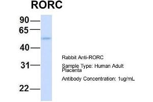 Host:  Rabbit  Target Name:  RORC  Sample Type:  Human Adult Placenta  Antibody Dilution:  1. (RORC 抗体  (Middle Region))