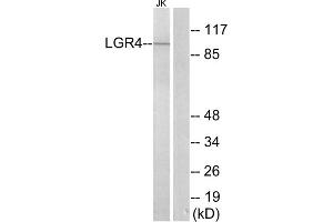 Western blot analysis of extracts from Jurkat cells, using LGR4 antibody. (LGR4 抗体  (Internal Region))