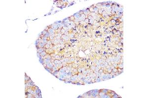 Immunohistochemistry of paraffin-embedded mouse testis using Integrin alpha 4 (ITG/CD49d) (ITG/CD49d) Rabbit mAb (054) at dilution of 1:100 (40x lens). (ITGA4 抗体)