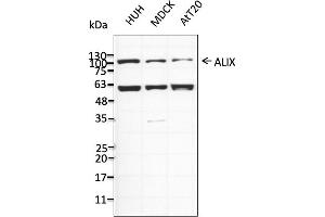 Western Blotting (WB) image for anti-Programmed Cell Death 6 Interacting Protein (PDCD6IP) (C-Term) antibody (ABIN7273068)
