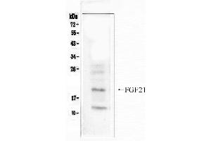 Western blot analysis of FGF21  using anti- FGF21 antibody . (FGF21 抗体  (N-Term))