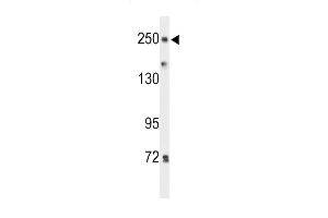 Western Blotting (WB) image for anti-Protein tyrosine Phosphatase, Receptor Type, D (PTPRD) (AA 343-371), (N-Term) antibody (ABIN653540)