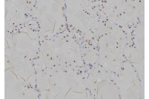 ABIN6277196 at 1/100 staining Human lung tissue by IHC-P. (Histone 3 抗体  (H3K9me2))