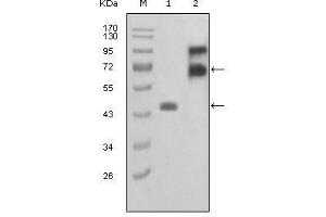Western Blot showing FBLN2 antibody used against truncated FBLN2-Trx recombinant protein (1) and truncated FBLN2 (aa28-444)-hIgGFc transfected COS7 cell lysate (2). (FBLN2 抗体  (AA 180-440))
