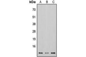 Western blot analysis of Osteocalcin expression in HEK293T (A), Raw264. (Osteocalcin 抗体  (Center))
