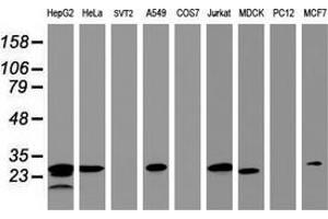 Western Blotting (WB) image for anti-Hydroxysteroid (17-Beta) Dehydrogenase 8 (HSD17B8) (AA 57-261) antibody (ABIN2715557) (HSD17B8 抗体  (AA 57-261))
