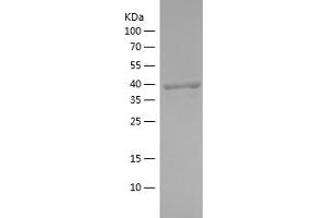 Flotillin 1 Protein (FLOT1) (AA 107-253) (His-IF2DI Tag)