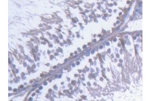Detection of KTN1 in Rat Testis Tissue using Polyclonal Antibody to Kinectin 1 (KTN1) (KTN1 抗体  (AA 1162-1325))
