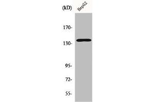 Western Blot analysis of HepG2 cells using p140Cap Polyclonal Antibody (SRCIN1 抗体  (Internal Region))