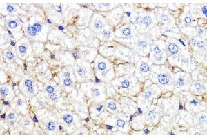 Immunohistochemistry (Paraffin-embedded Sections) (IHC (p)) image for anti-Bone Morphogenetic Protein Receptor, Type IB (BMPR1B) antibody (ABIN7260047)
