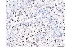 IHC analysis of GGCX using anti-GGCX antibody (ABIN7602419).