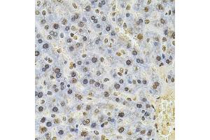 Immunohistochemistry of paraffin-embedded rat liver using PSMC3 Antibody (ABIN5971034) at dilution of 1/100 (40x lens). (PSMC3 抗体)