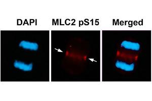Immunofluorescence staining of methanol-fixed U87 cells using MLC2 (Phospho-Ser15) Antibody. (MYL9 抗体  (pSer15))