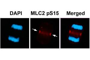 Immunofluorescence staining of methanol-fixed U87 cells using MLC2 (Phospho-Ser15) Antibody.