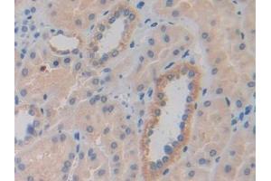 Immunohistochemistry (IHC) image for anti-Cysteine-Rich, Angiogenic Inducer, 61 (CYR61) (AA 178-381) antibody (ABIN7436243)