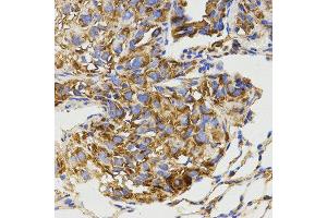 Immunohistochemistry (IHC) image for anti-Glutamate Receptor, Metabotropic 8 (GRM8) antibody (ABIN3017086) (GRM8 抗体)
