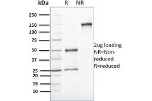SDS-PAGE Analysis Purified Involucrin Mouse Monoclonal Antibody (SPM259). (Involucrin 抗体)