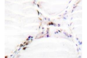 Immunohistochemistry analysis of Vitamin D3 receptor / NR1I1 antibody in paraffin-embedded human thyroid gland tissue. (Vitamin D Receptor 抗体)