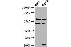 Western Blot Positive WB detected in: K562 whole cell lysate, HepG2 whole cell lysate All lanes: GATB antibody at 3. (PET112L 抗体  (AA 301-383))