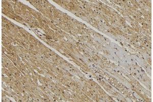 ABIN6272868 at 1/100 staining Mouse muscle tissue by IHC-P. (YME1L1 抗体  (C-Term))