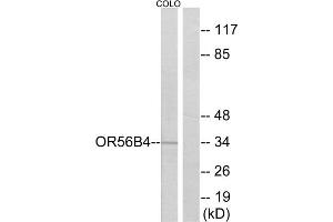 Western blot analysis of extracts from COLO cells, using OR56B4 antibody. (OR56B4 抗体  (C-Term))