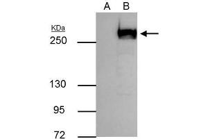 IP Image mTOR antibody immunoprecipitates mTOR protein in IP experiments.