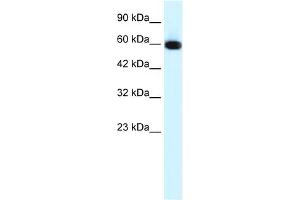 WB Suggested Anti-GLIS2 Antibody Titration:  0. (GLIS2 抗体  (N-Term))