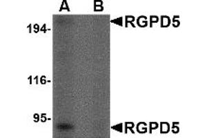 Western Blotting (WB) image for anti-RANBP2-Like and GRIP Domain Containing 5 (RGPD5) (Middle Region) antibody (ABIN1031059)