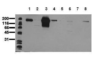 Western Blotting (WB) image for anti-Receptor tyrosine-protein kinase erbB-2 (ErbB2/Her2) (AA 860-880) antibody (ABIN126788) (ErbB2/Her2 抗体  (AA 860-880))