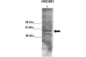 Lanes : Lane 1: 50ug monkey brain extract  Primary Antibody Dilution :  1:1000   Secondary Antibody : Goat anti rabbit-HRP  Secondary Antibody Dilution :  1:10,000  Gene Name : HSD3B1  Submitted by : Jonathan Bertin, Endoceutics Inc. (HSD3B1 抗体  (N-Term))
