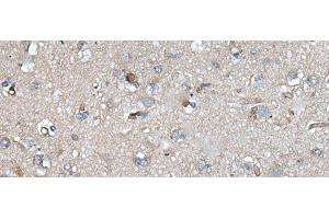 Immunohistochemistry of paraffin-embedded Human brain tissue using UMPS Polyclonal Antibody at dilution of 1:40(x200) (UMPS 抗体)