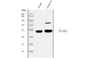 Western blot analysis of TEAD3 using anti-TEAD3 antibody (ABIN7603097).