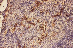 Immunohistochemistry (IHC) image for anti-Complement Component 5 (C5) (AA 1-18), (N-Term) antibody (ABIN3044294)