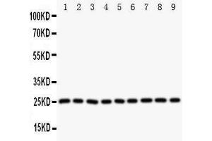 Western Blotting (WB) image for anti-Superoxide Dismutase 2, Mitochondrial (SOD2) (AA 45-62), (N-Term) antibody (ABIN3044165) (SOD2 抗体  (N-Term))