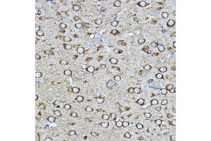 Immunohistochemistry of paraffin-embedded mouse brain using [KO Validated] CRMP2/CRMP2/DPYSL2 Rabbit pAb (ABIN7266769) at dilution of 1:400 (40x lens). (DPYSL2 抗体  (AA 400-500))