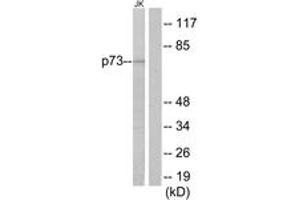 Western blot analysis of extracts from Jurkat cells, using p73 Antibody.