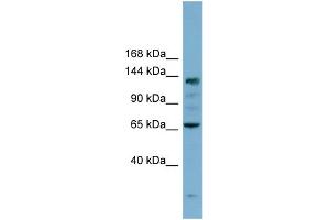 WB Suggested Anti-IARS Antibody Titration: 0. (IARS 抗体  (N-Term))