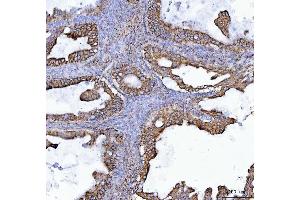 IHC analysis of COX5B using anti-COX5B antibody (ABIN7598975).