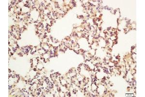 Formalin-fixed and paraffin embedded rat lung labeled with Rabbit Anti-Apg12 Polyclonal Antibody, Unconjugated  at 1:200 followed by conjugation to the secondary antibody and DAB staining (ATG12 抗体  (AA 101-187))