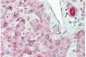 Immunohistochemistry (IHC) image for anti-Insulin-Like Growth Factor Binding Protein, Acid Labile Subunit (IGFALS) (AA 287-336) antibody (ABIN6752958)
