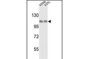 Western blot analysis of HSPH1 Antibody (C-term) (ABIN389381 and ABIN2839476) in  and  cell line lysates (35 μg/lane). (HSPH1 抗体  (C-Term))