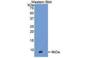 Western blot analysis of the recombinant protein. (DEFB103A 抗体  (AA 23-67))