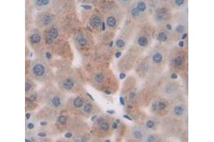 IHC-P analysis of Mouse Tissue, with DAB staining. (MYH1 抗体  (AA 1585-1642))