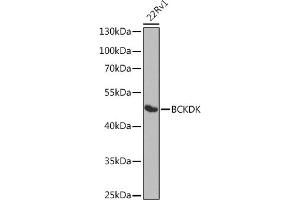Western blot analysis of extracts of 22Rv1 cells, using BCKDK antibody (ABIN6127484, ABIN6137492, ABIN6137493 and ABIN6224210) at 1:1000 dilution. (BCKDK 抗体  (AA 153-412))