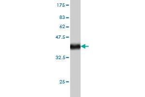 Western Blot detection against Immunogen (36. (POLA1 抗体  (AA 1363-1462))