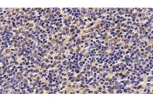 Detection of Surv in Human Spleen Tissue using Monoclonal Antibody to Survivin (Surv)