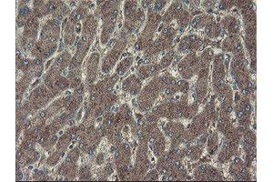 Image no. 5 for anti-rho GTPase Activating Protein 2 (ARHGAP2) antibody (ABIN1499629)