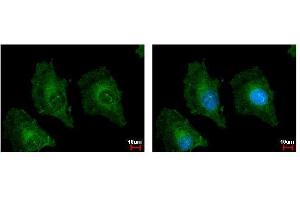 ICC/IF Image TSPAN3 antibody detects TSPAN3 protein at cytoplasm by immunofluorescent analysis. (Tetraspanin 3 抗体)
